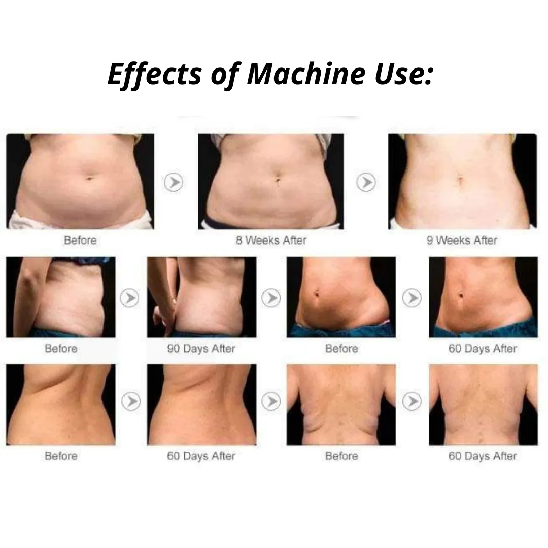 Adonis 9 in 1 Cavitation Machine for Toning & Slimming