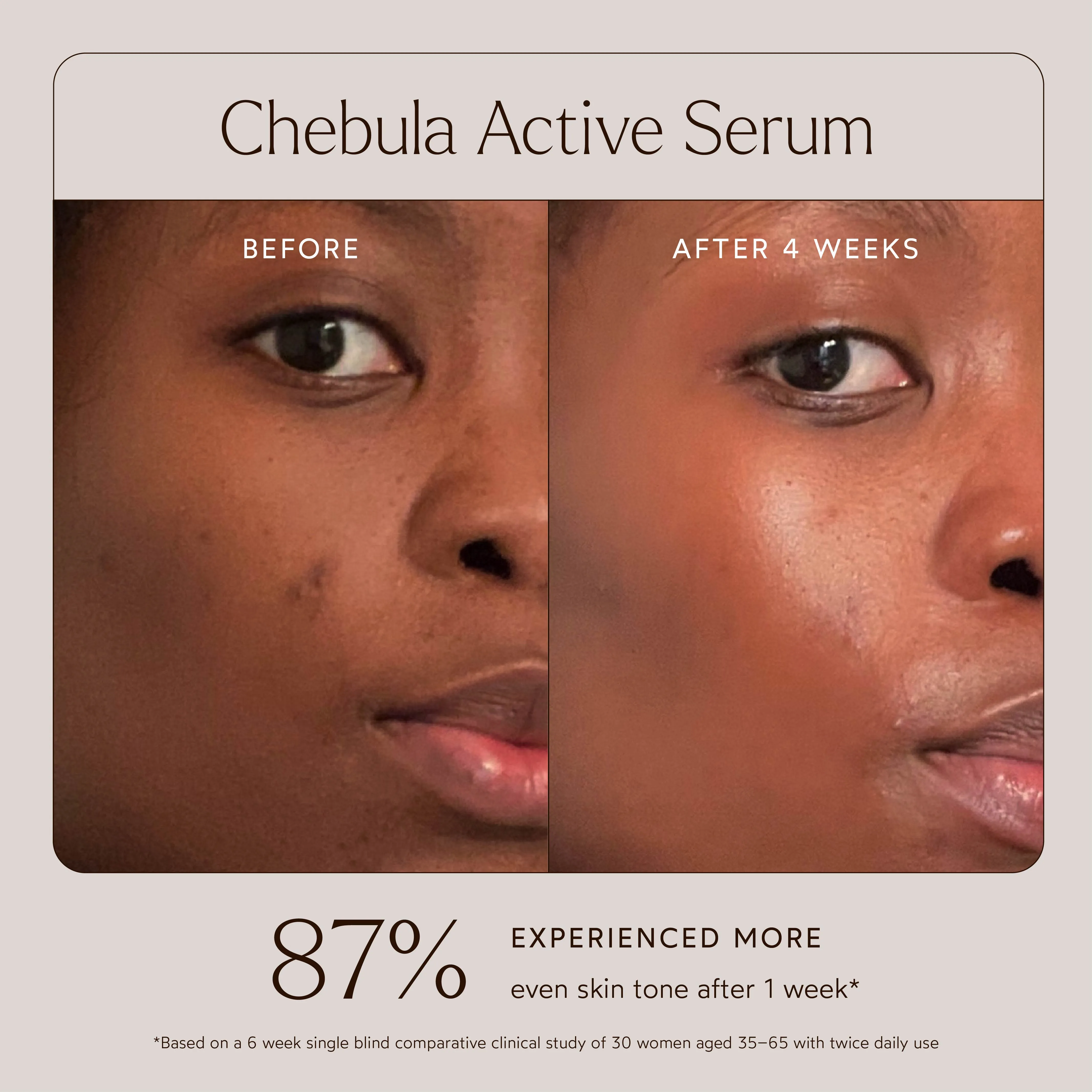 Chebula Active Anti-Aging Serum