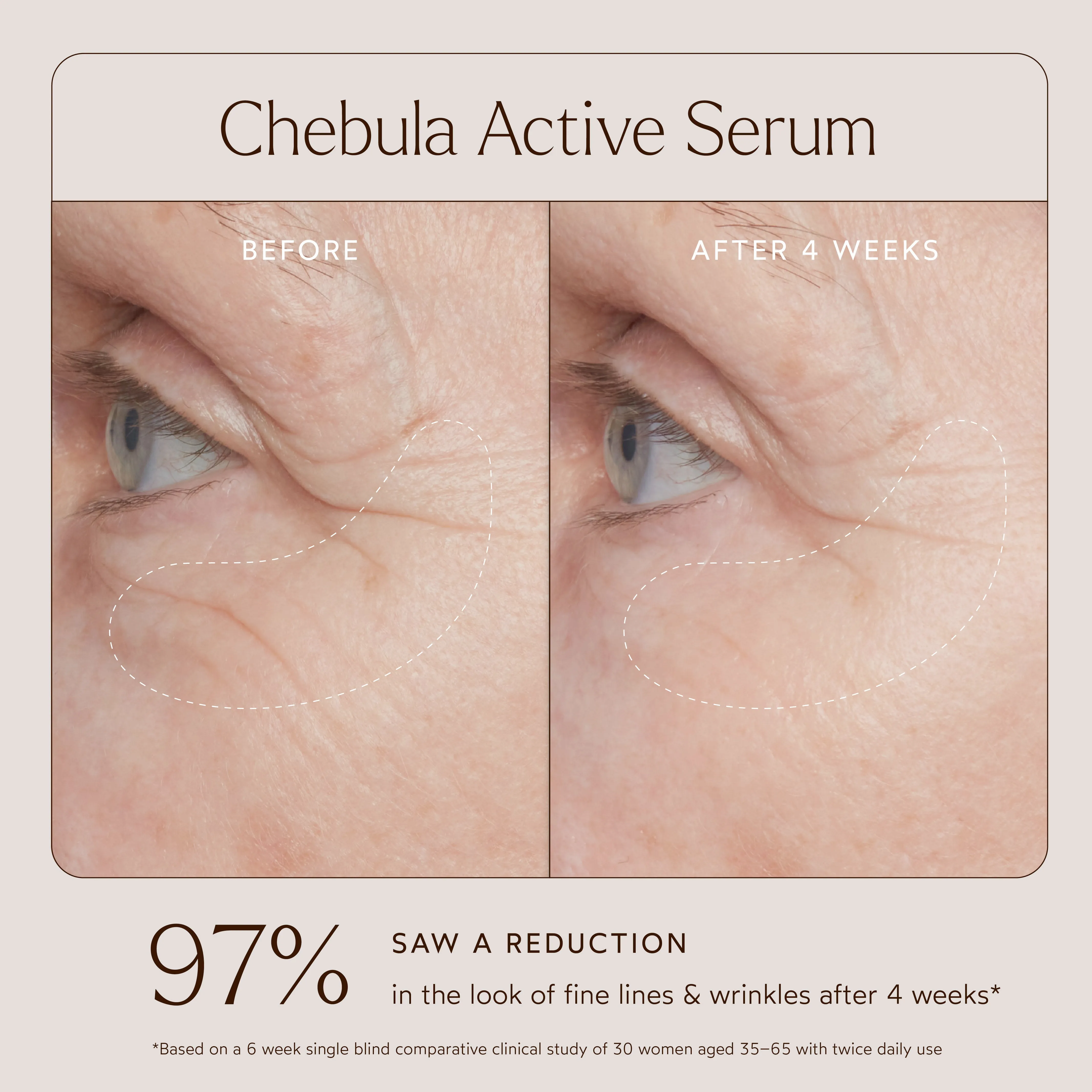 Chebula Active Anti-Aging Serum