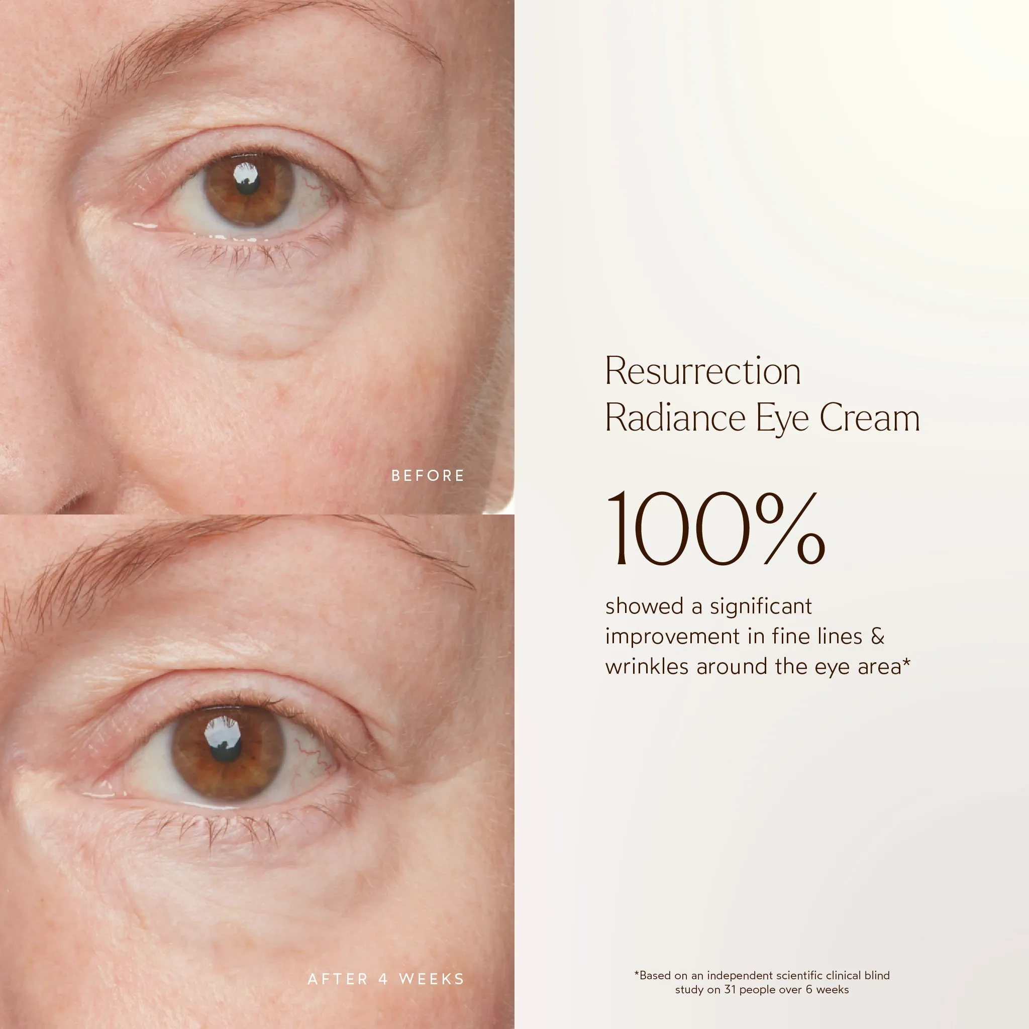 Resurrection Radiance Anti-Aging Eye Cream