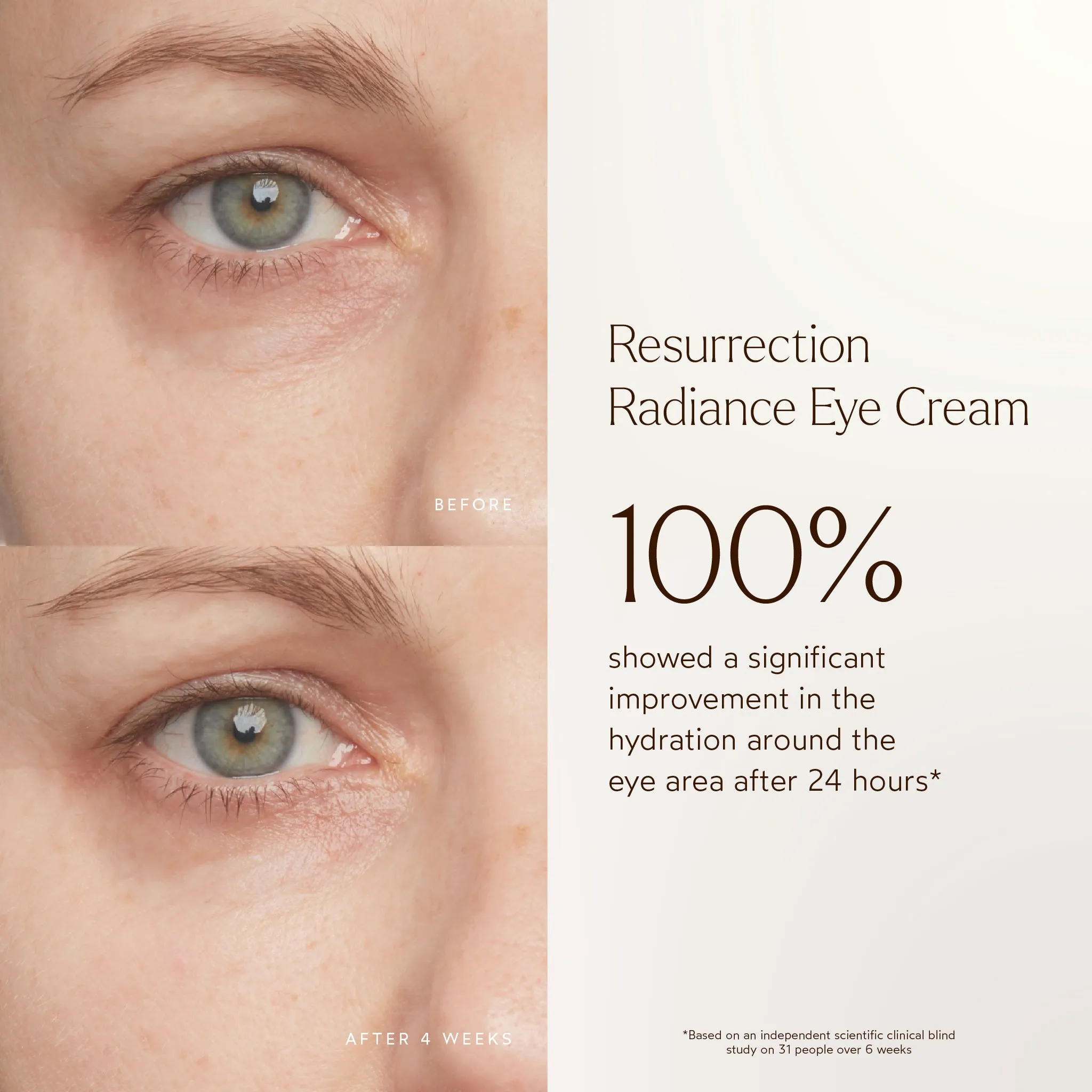 Resurrection Radiance Anti-Aging Eye Cream
